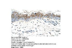 Rabbit Anti-GEM Antibody  Paraffin Embedded Tissue: Human Skin Cellular Data: Squamous epithelial cells Antibody Concentration: 4. (GEM antibody  (C-Term))