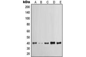 Western blot analysis of Cytokeratin 19 expression in MCF7 (A), A431 (B), HeLa (C), HT29 (D), HepG2 (E) whole cell lysates. (Cytokeratin 19 antibody  (C-Term))