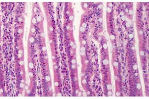 Human Small Intestine: Formalin-Fixed, Paraffin-Embedded (FFPE) (TRAF3 antibody  (N-Term))