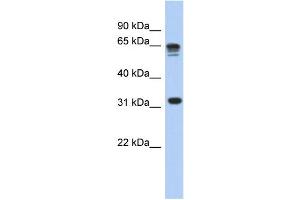 WB Suggested Anti-RPS3A Antibody Titration: 0. (RPS3A antibody  (N-Term))