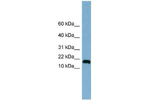 WB Suggested Anti-ANKRD37 Antibody Titration: 0. (ANKRD37 antibody  (Middle Region))