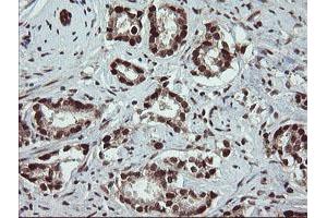 Image no. 9 for anti-Replication Factor C (Activator 1) 2, 40kDa (RFC2) (AA 1-234) antibody (ABIN1490617)