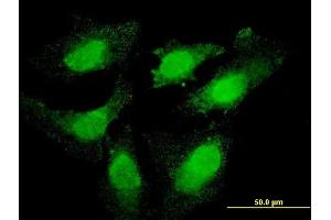 Immunofluorescence of monoclonal antibody to TOP3B on HeLa cell. (TOP3B antibody  (AA 1-862))