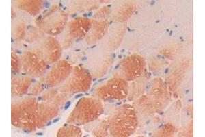DAB staining on IHC-P; Samples: Mouse Skeletal muscle Tissue (PDGFC antibody  (AA 23-345))