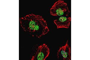 Immunofluorescence (IF) image for anti-Nucleolin (NCL) (AA 428-455) antibody (ABIN655626)