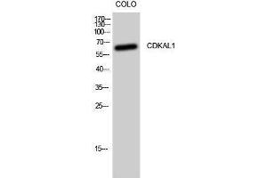 Western Blotting (WB) image for anti-CDK5 Regulatory Subunit Associated Protein 1-Like 1 (CDKAL1) (N-Term) antibody (ABIN3183845) (CDKAL1 antibody  (N-Term))