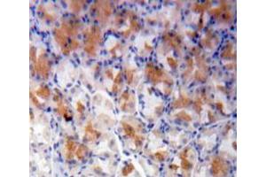 Used in DAB staining on fromalin fixed paraffin-embedded stomach tissue (NT5C3 antibody  (AA 1-297))