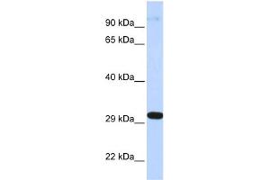 WB Suggested Anti-ZNF688 Antibody Titration:  0. (ZNF688 antibody  (Middle Region))