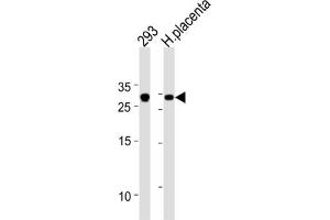 Western Blotting (WB) image for anti-Transcription Factor 21 (TCF21) antibody (ABIN2996267)