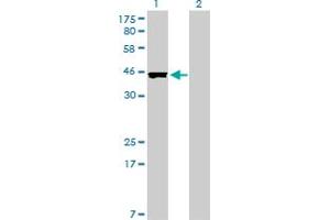 Western Blot analysis of CREB3L4 expression in transfected 293T cell line by CREB3L4 monoclonal antibody (M01), clone 3E3. (CREB3L4 antibody  (AA 1-110))