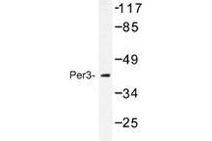 Western blot analysis of Per3 antibody in extracts from Jurkat cells treated with insulin 0.