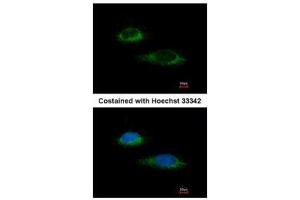 ICC/IF Image Immunofluorescence analysis of methanol-fixed HeLa, using Glutamate Dehydrogenase, antibody at 1:100 dilution. (GLUD1 antibody)