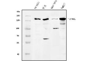 Western blot analysis of PML Protein/Pml using anti-PML Protein/Pml antibody (ABIN7599678).
