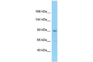 WB Suggested Anti-ESCO1 Antibody Titration: 1. (ESCO1 antibody  (N-Term))