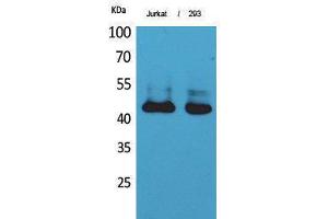 Western Blotting (WB) image for anti-SCCA1/2 (Internal Region) antibody (ABIN3181018) (SCCA1/2 (Internal Region) antibody)