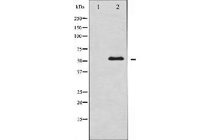 Western blot analysis of Chk1 expression in COS7 whole cell lysates,The lane on the left is treated with the antigen-specific peptide. (CHEK1 antibody  (Internal Region))