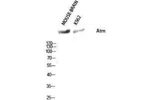 Western Blotting (WB) image for anti-Ataxia Telangiectasia Mutated (ATM) (Ser159) antibody (ABIN3183427) (ATM antibody  (Ser159))