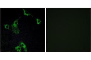 Immunofluorescence analysis of COS7 cells, using CIDEB Antibody. (CIDEB antibody  (AA 91-140))