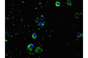 Immunofluorescent analysis of U251 cells using ABIN7151966 at dilution of 1:100 and Alexa Fluor 488-congugated AffiniPure Goat Anti-Rabbit IgG(H+L)