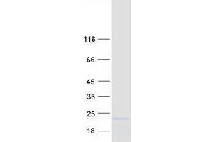 Validation with Western Blot (ASF1B Protein (Myc-DYKDDDDK Tag))