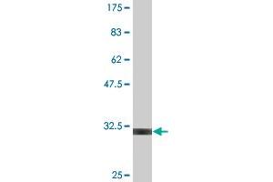 Western Blot detection against Immunogen (29. (UCP1 antibody  (AA 232-267))