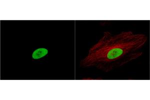 ICC/IF Image Ku80 antibody [N3C2], Internal detects Ku80 protein at nucleus by immunofluorescent analysis. (X-Ray Repair Cross Complementing 5 antibody)