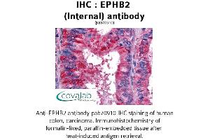 Image no. 1 for anti-EPH Receptor B2 (EPHB2) (Internal Region) antibody (ABIN1734081) (EPH Receptor B2 antibody  (Internal Region))