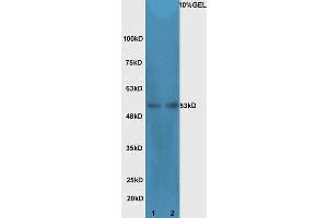Lane 1: Mouse intestinal lysates Lane 2: mouse testicular lysates  probed with Rabbit Anti-Cdc25C Polyclonal Antibody, Unconjugated (ABIN1387108) at 1:300 overnight at 4 °C. (CDC25C antibody  (AA 290-340))