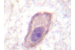 Immunohistochemistry analyzes of IFNGRA antibody in paraffin-embedded human brain tissue. (IFNGR1 antibody)
