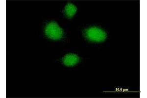 Immunofluorescence of purified MaxPab antibody to HSH2D on HeLa cell. (HSH2D antibody  (AA 1-352))