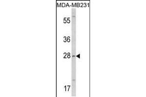 Western blot analysis of COLEC11 Antibody in MDA-MB231 cell line lysates (35ug/lane)