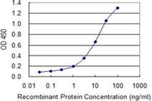 Detection limit for recombinant GST tagged XPR1 is 0. (xpr1 antibody  (AA 598-695))