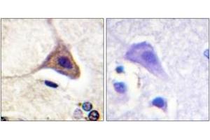 Immunohistochemistry analysis of paraffin-embedded human brain, using Opioid Receptor-delta (Phospho-Ser363) Antibody. (OPRD1 antibody  (pSer363))