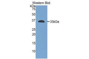 Western Blotting (WB) image for anti-Integrin beta 4 (ITGB4) (AA 923-1197) antibody (ABIN1859507) (Integrin beta 4 antibody  (AA 923-1197))