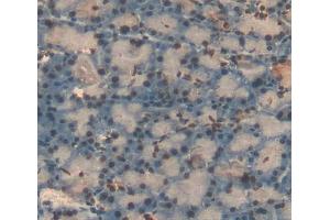 Immunohistochemistry (IHC) image for anti-Nuclear Receptor Subfamily 5, Group A, Member 2 (NR5A2) (AA 1-205) antibody (ABIN1869035)