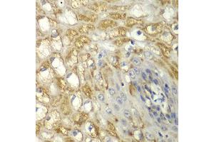 Immunohistochemistry of paraffin-embedded human esophageal using MYO1C antibody at dilution of 1:100 (x40 lens). (Myosin IC antibody)