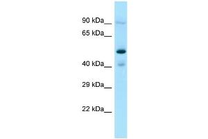 Host: Rabbit Target Name: OSGEPL1 Sample Type: Jurkat Whole Cell lysates Antibody Dilution: 1. (OSGEPL1 antibody  (C-Term))