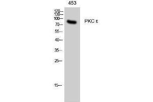 Western Blotting (WB) image for anti-Protein Kinase C, epsilon (PRKCE) (Thr308) antibody (ABIN3176925) (PKC epsilon antibody  (Thr308))