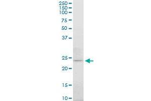 ATG5 monoclonal antibody (M06), clone 3G11. (ATG5 antibody  (AA 176-275))