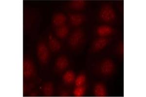 Image no. 3 for anti-Ribosomal Protein S6 Kinase, 70kDa, Polypeptide 1 (RPS6KB1) (pThr421) antibody (ABIN197014) (RPS6KB1 antibody  (pThr421))