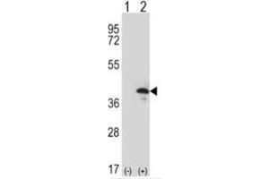 Western blot analysis: ZWINT Antibody staining of 293 cell lysates (2 µg/lane) either nontransfected (Lane 1) or transiently transfected (Lane 2) with the ZWINT gene. (ZWINT antibody  (Middle Region))
