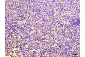 Formalin-fixed and paraffin embedded mouse lymphoma tissue labeled with Anti-CD24 Polyclonal Antibody, Unconjugated (ABIN1385707) at 1:200 followed by conjugation to the secondary antibody (CD24 antibody  (AA 27-53))