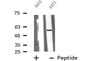 Western blot analysis of Cytochrome P450 51A1 using A431 whole cell lysates (CYP51A1 antibody  (Internal Region))
