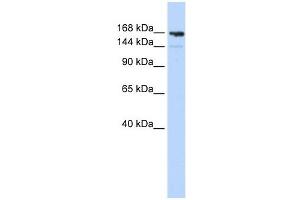 Periplakin antibody used at 1 ug/ml to detect target protein.