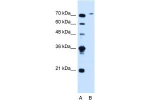 WB Suggested Anti-SLCO6A1 Antibody Titration:  1. (SLCO6A1 antibody  (C-Term))
