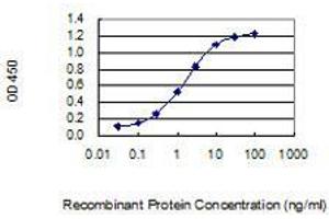 Detection limit for recombinant GST tagged MAGEA5 is 0. (MAGEA5 antibody  (AA 60-124))