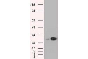 HEK293T cells were transfected with the pCMV6-ENTRY control (Left lane) or pCMV6-ENTRY EMG1 (Right lane) cDNA for 48 hrs and lysed. (EMG1 antibody)