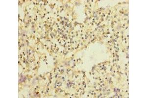 Immunohistochemistry of paraffin-embedded human spleen tissue using ABIN7147969 at dilution of 1:100 (SLC35A1 antibody  (AA 1-100))