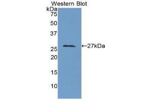 Western Blotting (WB) image for anti-Lysyl Oxidase-Like 3 (LOXL3) (AA 509-712) antibody (ABIN1859688) (LOXL3 antibody  (AA 509-712))