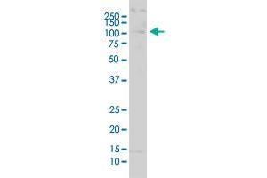 USP51 polyclonal antibody (A01). (USP51 antibody  (AA 261-337))